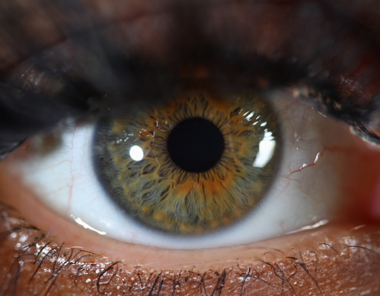 Iridology